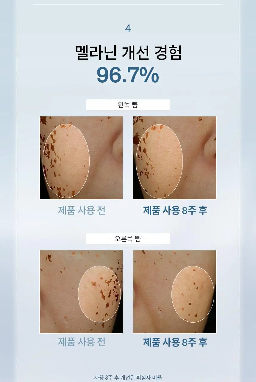 [NEW/미백] 설화수 자정앰플세럼 30ml 단품/기획 상세페이지 9